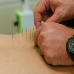 Can Acupuncture Help Back Pain
