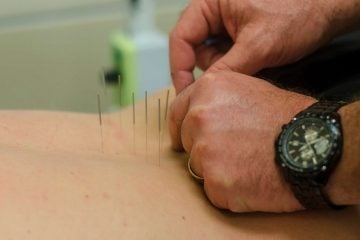 Can Acupuncture Help Back Pain