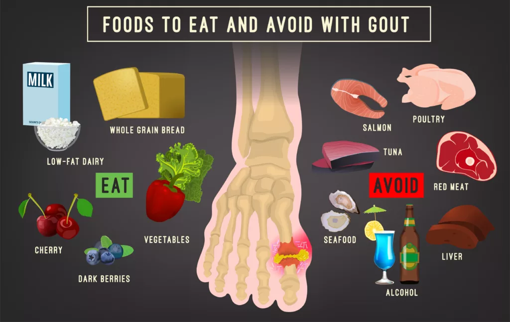 Gout arthritis
